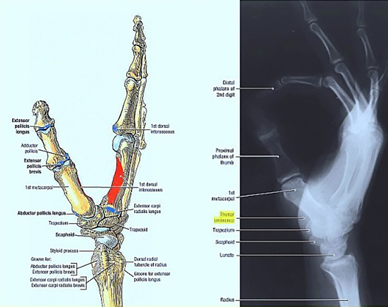 hand diagram